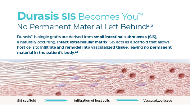 Durasis SIS Becomes You